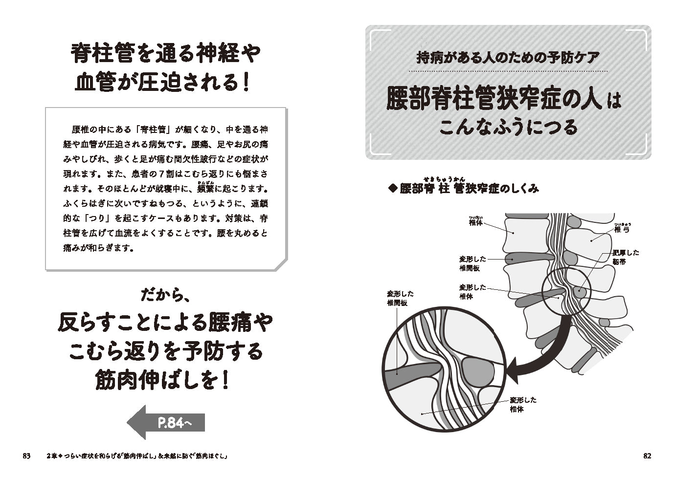 こむら返り・体がよく「つる」人のための30秒筋肉ほぐし